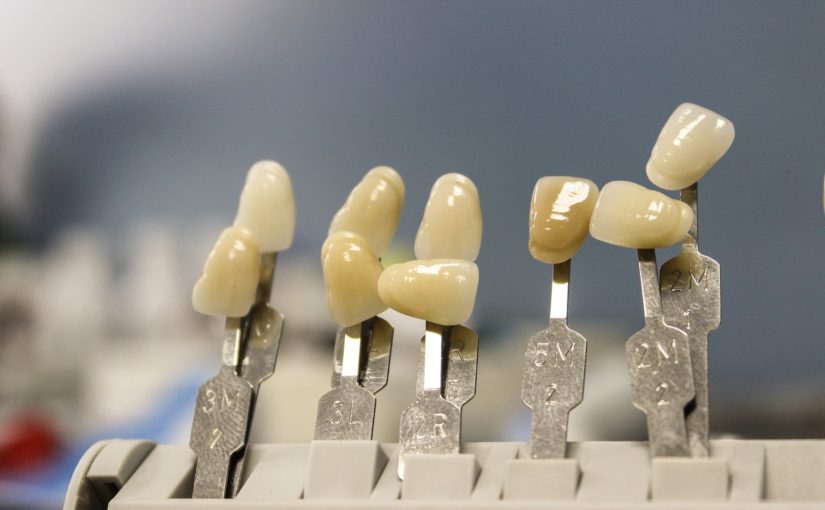 Ładne urodziwe zęby również olśniewający cudny uśmieszek to powód do zadowolenia.